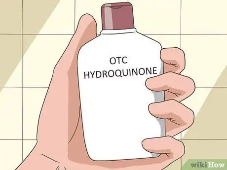 Image titled Treat Melasma Step 12