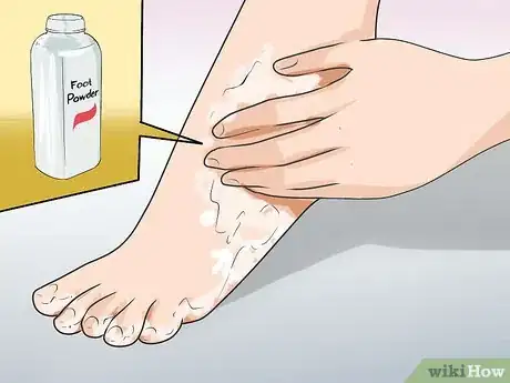 Image titled Prevent the Spread of Fungal Infections Step 12