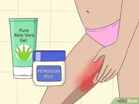 Image titled Prevent Chafing Between Your Legs Step 9