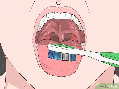 Image titled Suppress the Gag Reflex Step 8