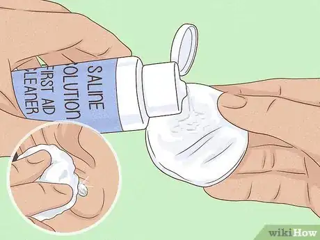 Image titled Clean a New Ear Piercing Step 12