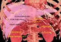 Rendement 3D d'un CT-scan, montrant l'artère splénique en haut à droite.