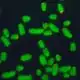 Image de chromosomes en vert au microscope