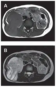Comparaison côte à côte de deux coupes IRM.