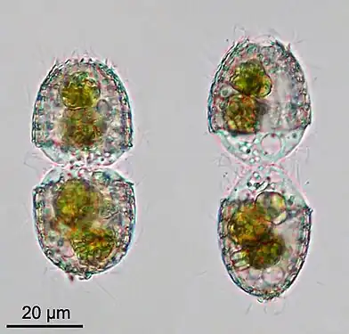 Coleps sp., phase précoce (gauche) et tardive (droite) de la division cellulaire