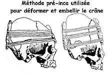 Méthode pré-Inca des planchettes