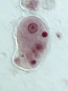 Trophozoïte d’Entamoeba histolytica.