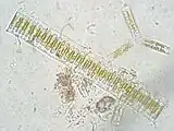 Fragilaria sp.