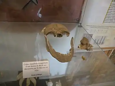 Crâne, mandibule et maxillaire de femme.