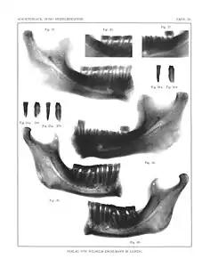 Radiographie.
