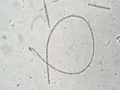 Planktothrix rubescens.