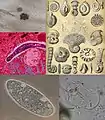 Protozoa.