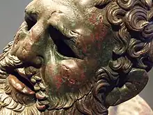 Séquelles sur le visage du pugiliste montrant la violence des combats.